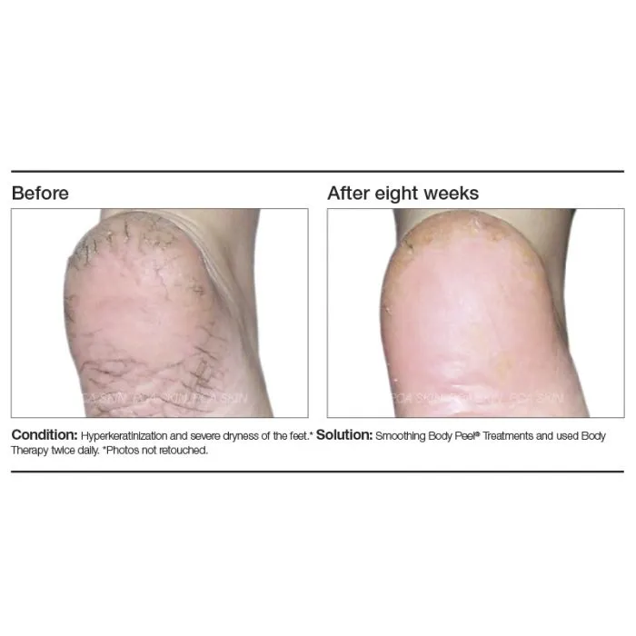 PCA Skin Body Therapy